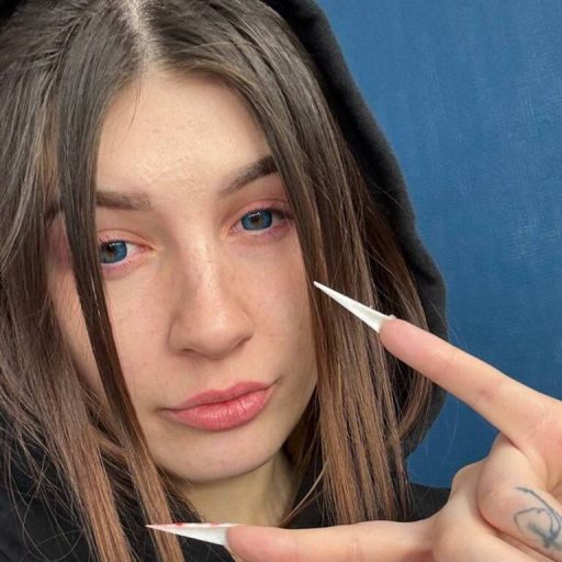 FemidaBrown strip amateur image