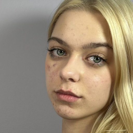 GerryThoburn amateur lush image