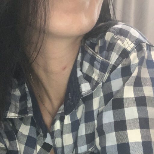LilySchmidt vibrator lj image